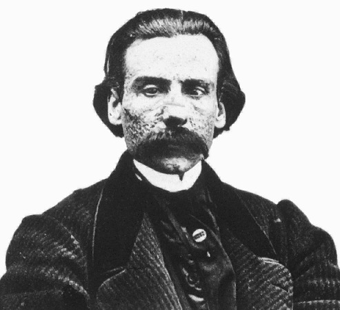 Каштелу Бранку (Castelo Branco) Феррейра Ботелью Камилу (1825—1890)